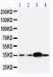 Apurinic/Apyrimidinic Endodeoxyribonuclease 1 antibody, LS-C312653, Lifespan Biosciences, Western Blot image 