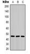 Keratin 18 antibody, LS-B16871, Lifespan Biosciences, Western Blot image 