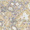 SMYD Family Member 5 antibody, A6191, ABclonal Technology, Immunohistochemistry paraffin image 