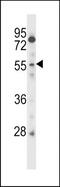 Cysteine And Serine Rich Nuclear Protein 2 antibody, TA324521, Origene, Western Blot image 