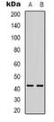 Alpha-Methylacyl-CoA Racemase antibody, LS-C413482, Lifespan Biosciences, Western Blot image 