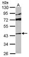 p38 MAPK antibody, LS-C155329, Lifespan Biosciences, Western Blot image 