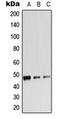 Adrenoceptor Beta 2 antibody, orb213534, Biorbyt, Western Blot image 