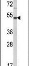 LUC7 Like 2, Pre-MRNA Splicing Factor antibody, PA5-26556, Invitrogen Antibodies, Western Blot image 