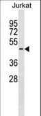 Serpin Family B Member 8 antibody, LS-C156044, Lifespan Biosciences, Western Blot image 