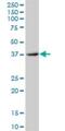 ERCC Excision Repair 8, CSA Ubiquitin Ligase Complex Subunit antibody, H00001161-B01P, Novus Biologicals, Western Blot image 