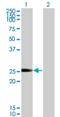 Nucleoredoxin Like 1 antibody, H00115861-M01, Novus Biologicals, Western Blot image 