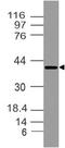 Zinc Finger DHHC-Type Containing 23 antibody, A13972, Boster Biological Technology, Western Blot image 
