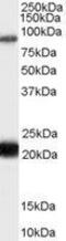 RasGAP-activating-like protein 1 antibody, GTX89190, GeneTex, Western Blot image 