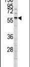 Menin 1 antibody, PA5-14312, Invitrogen Antibodies, Western Blot image 