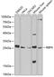 Retinol Binding Protein 4 antibody, GTX54709, GeneTex, Western Blot image 