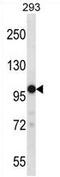 Transient Receptor Potential Cation Channel Subfamily M Member 4 antibody, AP54363PU-N, Origene, Western Blot image 