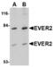 Transmembrane Channel Like 8 antibody, LS-B3804, Lifespan Biosciences, Western Blot image 