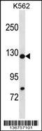 Histone Cell Cycle Regulator antibody, 58-871, ProSci, Western Blot image 