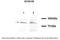 Sodium Channel Epithelial 1 Beta Subunit antibody, 28-219, ProSci, Western Blot image 