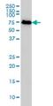 NDC80 Kinetochore Complex Component antibody, H00010403-M01, Novus Biologicals, Western Blot image 