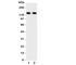 Zinc Finger E-Box Binding Homeobox 2 antibody, R31062, NSJ Bioreagents, Western Blot image 