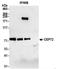 Centrosomal Protein 72 antibody, NB100-60661, Novus Biologicals, Western Blot image 