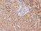 Leucine-, glutamate- and lysine-rich protein 1 antibody, 205652-T08, Sino Biological, Immunohistochemistry paraffin image 