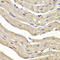 COP9 Signalosome Subunit 3 antibody, LS-C346188, Lifespan Biosciences, Immunohistochemistry paraffin image 