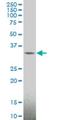 MAGE Family Member A4 antibody, H00004103-M01, Novus Biologicals, Western Blot image 