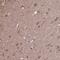 Acyl-CoA Thioesterase 6 antibody, NBP2-31708, Novus Biologicals, Immunohistochemistry paraffin image 