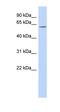 Transmembrane Protein 209 antibody, orb326271, Biorbyt, Western Blot image 