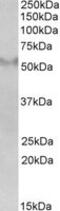 Fibronectin Type III And SPRY Domain Containing 1 antibody, MBS420504, MyBioSource, Western Blot image 