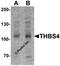 Thrombospondin 4 antibody, 6843, ProSci, Western Blot image 