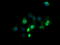 Zinc finger and SCAN domain-containing protein 21 antibody, TA506118BM, Origene, Immunofluorescence image 