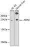 CD70 antigen antibody, GTX53916, GeneTex, Western Blot image 