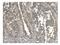 Gasdermin D antibody, A02842, Boster Biological Technology, Immunohistochemistry paraffin image 