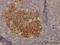 Phosphoglycerate Dehydrogenase antibody, H00026227-M01, Novus Biologicals, Immunohistochemistry paraffin image 