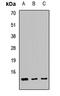 ATP Synthase Inhibitory Factor Subunit 1 antibody, LS-C668492, Lifespan Biosciences, Western Blot image 