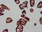 DnaJ Heat Shock Protein Family (Hsp40) Member A1 antibody, CSB-PA006999LA01HU, Cusabio, Immunohistochemistry paraffin image 