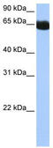 NOP2/Sun RNA Methyltransferase 6 antibody, TA344028, Origene, Western Blot image 