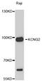 Potassium Voltage-Gated Channel Subfamily Q Member 2 antibody, abx126042, Abbexa, Western Blot image 