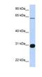 Ral GEF with PH domain and SH3-binding motif 1 antibody, NBP1-58314, Novus Biologicals, Western Blot image 