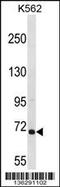 Rac/Cdc42 Guanine Nucleotide Exchange Factor 6 antibody, 58-685, ProSci, Western Blot image 