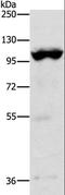 Transient Receptor Potential Cation Channel Subfamily M Member 5 antibody, LS-C402832, Lifespan Biosciences, Western Blot image 