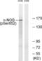 Nitric Oxide Synthase 1 antibody, LS-C199333, Lifespan Biosciences, Western Blot image 