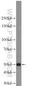 Keratin 12 antibody, 24789-1-AP, Proteintech Group, Western Blot image 