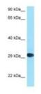 CD58 Molecule antibody, NBP1-98401, Novus Biologicals, Western Blot image 