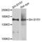 Adenylate Cyclase 2 antibody, LS-C411333, Lifespan Biosciences, Western Blot image 