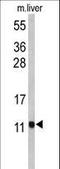 Pterin-4 Alpha-Carbinolamine Dehydratase 1 antibody, LS-C163406, Lifespan Biosciences, Western Blot image 