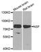 N-Ethylmaleimide Sensitive Factor, Vesicle Fusing ATPase antibody, abx005948, Abbexa, Western Blot image 