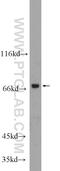 Alpha-1,3-Mannosyl-Glycoprotein 4-Beta-N-Acetylglucosaminyltransferase A antibody, 25109-1-AP, Proteintech Group, Western Blot image 