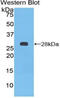 Patched 1 antibody, MBS2004836, MyBioSource, Western Blot image 