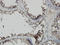 PDZ Binding Kinase antibody, LS-C133784, Lifespan Biosciences, Immunohistochemistry paraffin image 