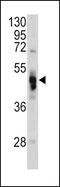 Galactosidase Alpha antibody, PA5-13687, Invitrogen Antibodies, Western Blot image 